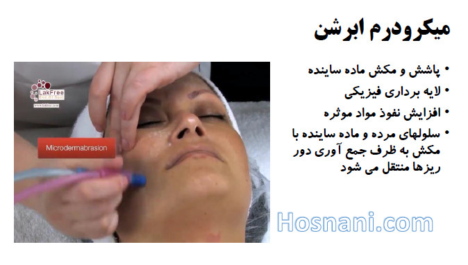 microdermabrasion technique sprays fine particles of aluminum oxide or sodium bicarbonate with a vacuum suction to gently sand away the thick outer layer of the skin to rejuvenate it